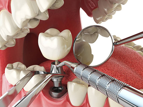 Best Emergency Dental Surgery in Diamond Ridge, AK