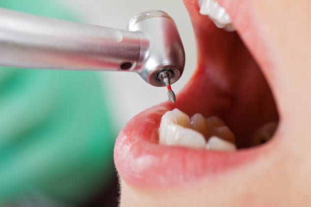Best Walk-In Emergency Dentist in Diamond Ridge, AK